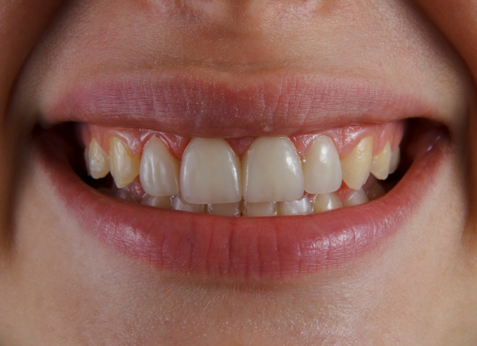 a close-up of a person's mouth
